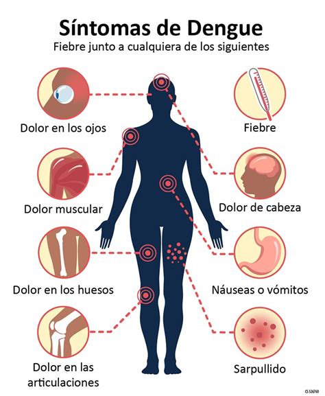 Síntomas Y Tratamiento Dengue Cdc