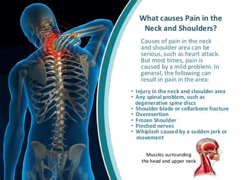Long muscle of the neck that extends from the mastoid process to the clavicle and sternum. Eating peanut butter while pregnant, shoulder pain at night in bed, causes of neck and shoulder ...