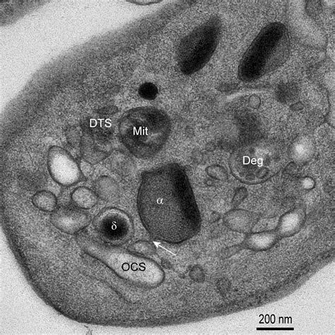 Transmission Electron Microscopy Of Platelets FROM Apheresis And Buffy Coat Derived Platelet