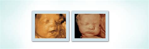 How much is a 3d ultrasound uk. How Much 3D & 4D Ultrasound Cost in Dubai? | Euromed® Clinic