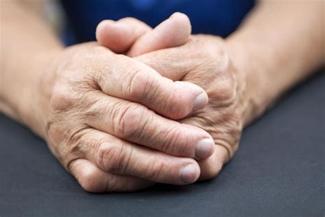 Rheumatoid Arthritis Ra 12 Early Signs