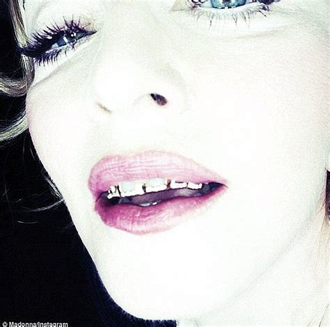 Grillz Why Are Madonna Rihanna And Miley Cyrus Sinking Their Teeth