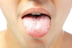How long does it take for swollen taste buds to heal? 11 Interesting Facts About Our Tongue & Taste Buds You Had ...