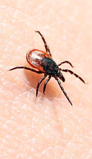 Borelioza może być diagnozowana na podstawie zmian narządowych, co jednak jest niezwykle trudne. Borelioza - fazy, objawy skórne, objawy narządowe ...