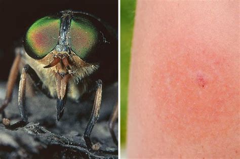 Horsefly Bite What Is A Horsefly How To Treat Bites As They Return To