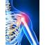 What Is A Frozen Shoulder And How It Treated  Waldegrave Clinic