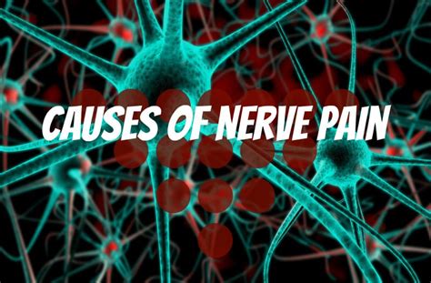 Common Causes Of Nerve Pain What Causes Chronic Nerve Pain