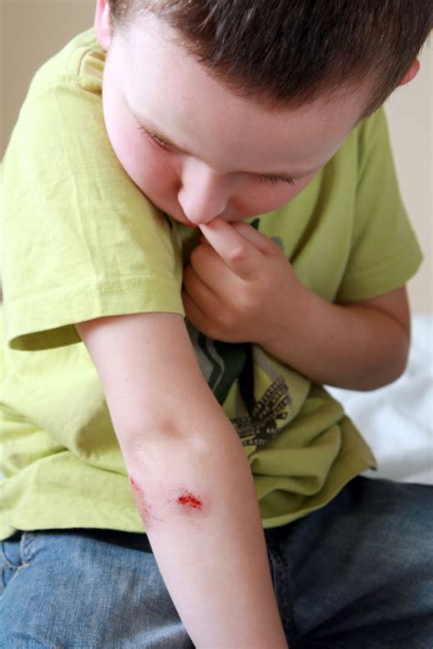 Cuts And Scrapes — Trailhead Pediatrics
