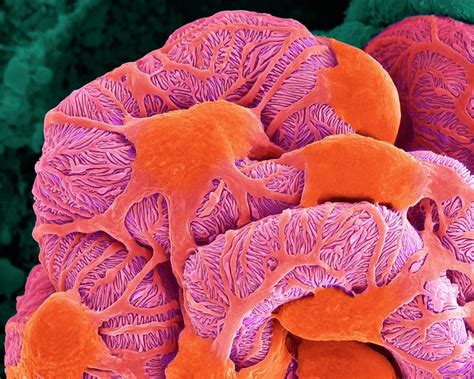 Kidney Glomerulus Photograph By Dennis Kunkel Microscopyscience Photo