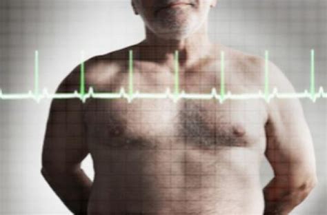 Stroke The Risk Increases After Heart Surgery Ace Mind