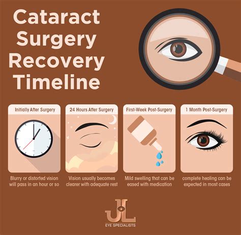 Cataract Surgery Recovery Timeline Dr Jimmy Lim Eye Specialist