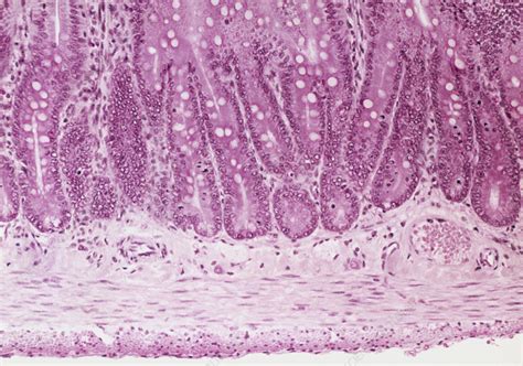 Lm Of A Section Through The Small Intestine Wall Stock Image P520