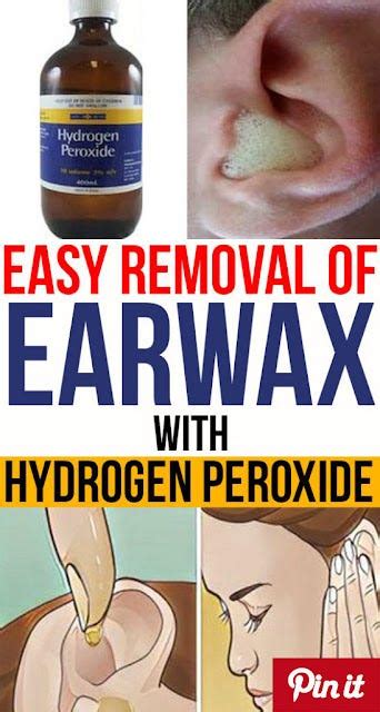 How To Use Hydrogen Peroxide To Remove Ear Wax Melani Ria Medium
