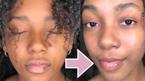 Dry Chapped Peeling Lips Transformation Youtube