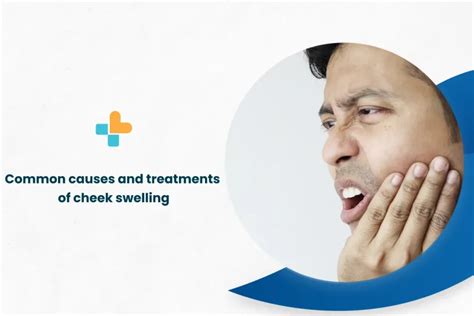 Common Causes And Treatments Of Cheek Swelling By Ayu Health