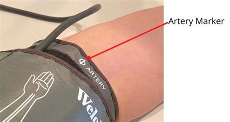 How To Use A Welch Allyn Blood Pressure Cuff