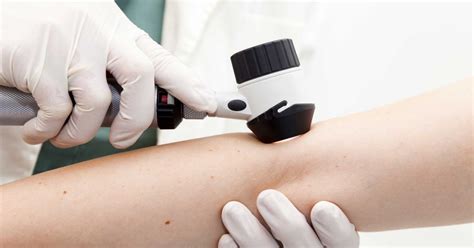 Two New Trials Show Promise For Future Skin Cancer Treatment Time