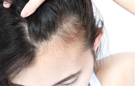 Top Signs Of New Hair Growth How To Spot