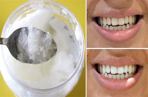 get rid of bad breath tartar and plaque in the mouth with this simple method mindwaft