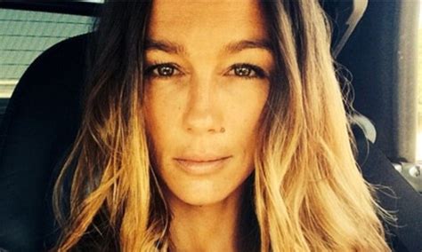 Sharni Vinson S Plastic Surgery What We Know So Far Surgery Lists