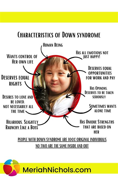 Characteristics of Down syndrome (with downloadable graphic) | Meriah