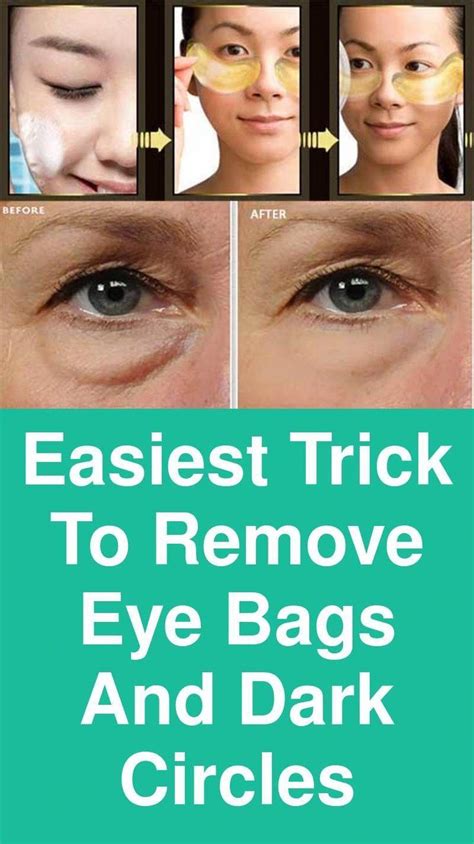 Easiest Trick To Remove Eye Bags And Dark Circles To Begin With Take