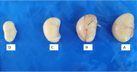 Photograph Showing Normal Testes A And Testicular Atrophy In