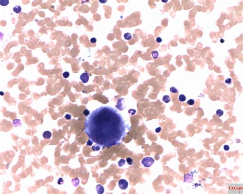 Platelets Hematology