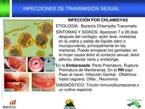 Ppt Infecciones De De Transmision Sexual Powerpoint Presentation Id