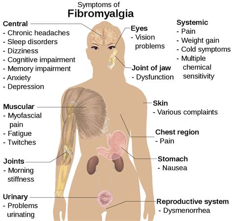 Fibromyalgia Diagnostic Criteria And The Danger Of Misdiagnosis Worldcare