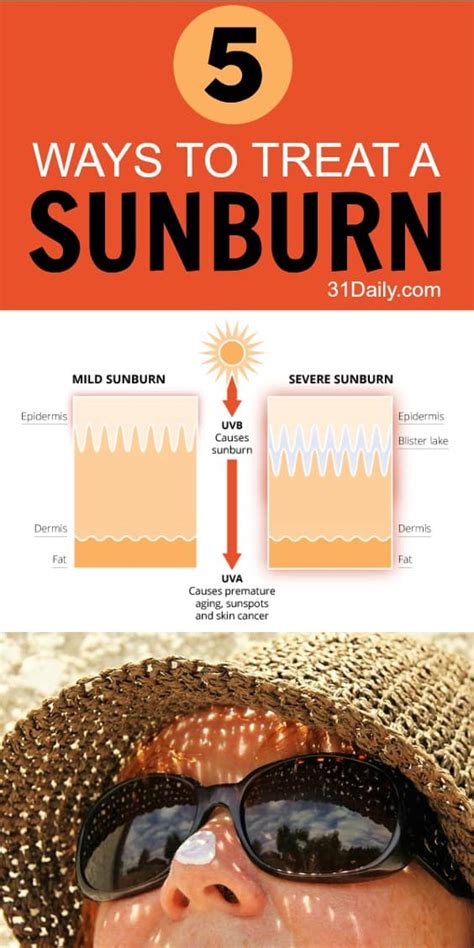 What Are The Chances Of Getting Cancer From Sunburn Cancerwalls