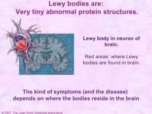 Read this to learn about the cause, symptoms and challenges. What is Lewy Body Dementia? | Aspen Senior Care