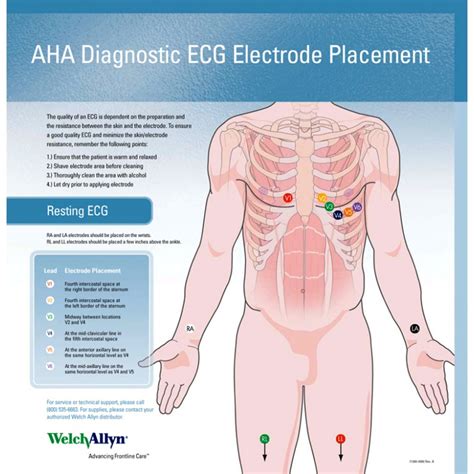 Welch Allyn Ecg Placement Wall Chart 71300 000