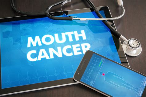 Why Schedule An Oral Cancer Screening Newport Beach Ca