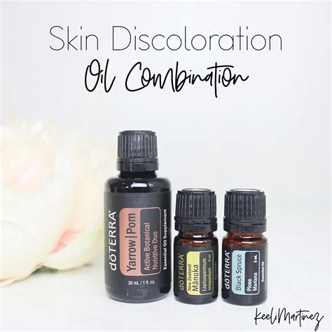 Dōterra Oils 🌱 Keeli Martinez On Instagram “three Oils That Show Off