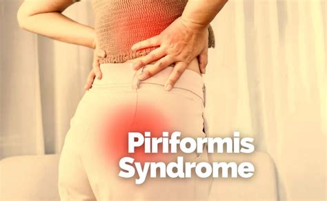 Understanding And Treating Piriformis Syndrome Rincon Chiropractic