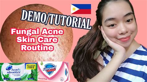 Although head & shoulders classic clean daily shampoo may not be the first product you'd think of putting on your face to treat fungal acne, it's on. FUNGAL ACNE SKIN CARE ROUTINE (Tutorial/Demo) Fungal Acne ...