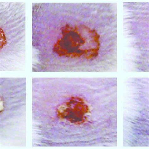 Pseudomonas Aeruginosa Infected Excisional Wounds In Mice Untreated