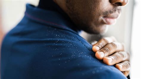 Foods to eat, foods to avoid, meal plan, shopping list, scientific background and other tips. Surprising Facts About Dandruff | Everyday Health