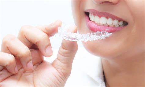 Know What Can Invisalign Do For Your Teeth