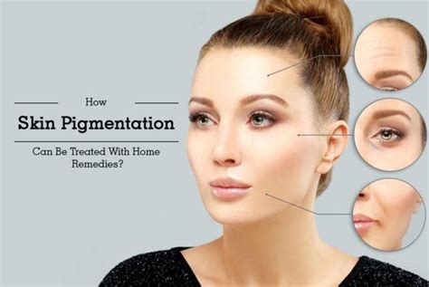 20 Tremendous Home Remedies For Skin Pigmentation My Health Only