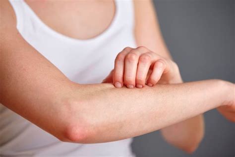This Is What Causes Those Red Bumps On Your Arms And How To Avoid