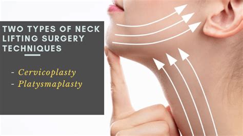 Neck Lift Cosmetic Surgery Types Costs And Information Answer