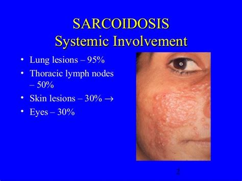 Sarcoidosis Skin Lesions