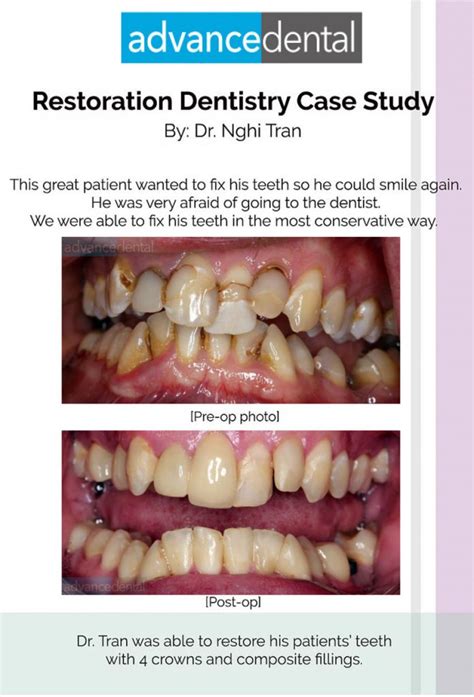 Case Studies Advance Dental