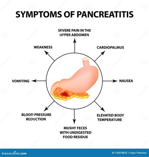 Symptoms Of Pancreatitis The Structure Of The Stomach And Pancreas