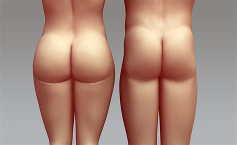Brazilian Butt Lift Implants For Guys Girls What Makes Buttocks