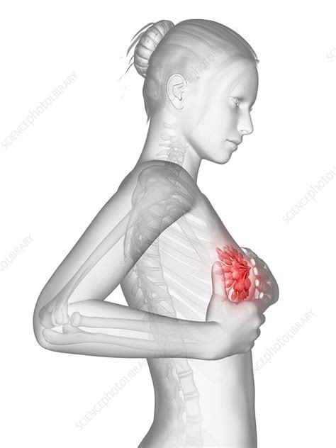 Female Breast Examination Illustration Stock Image F011 0693