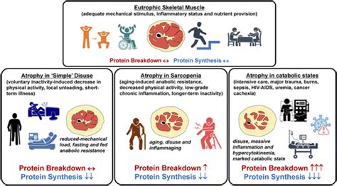 Disuse Induced Skeletal Muscle Atrophy In Disease And Nondisease States