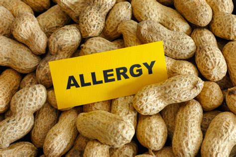 What Are Peanut Allergy Symptoms Food Allergies Atlanta